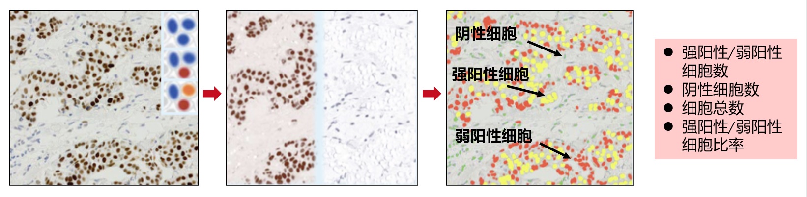 Ki67细胞核阳性率.jpg